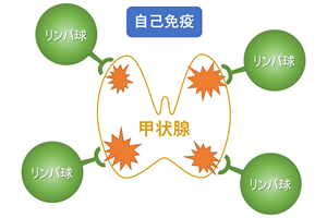 病 コロナ 橋本 バセドウ病や橋本病と新型コロナウイルス感染症情報