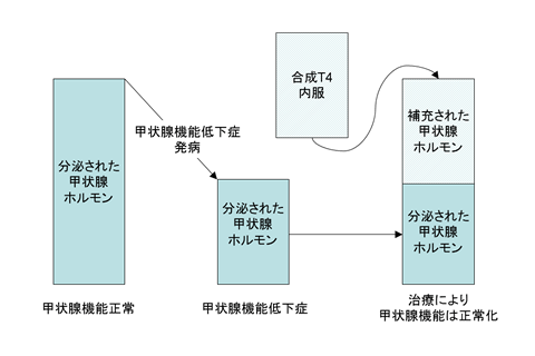 橋本病 甲状腺機能低下症 甲状腺専門の岡本甲状腺クリニック 大阪市